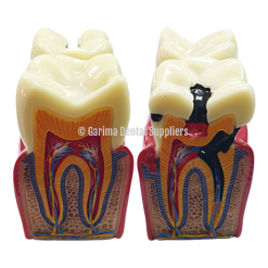 Unique Dental - Tooth Model S11