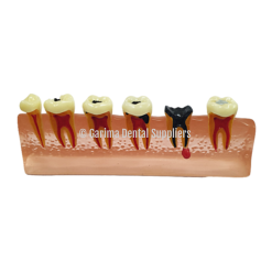 Unique Dental - Tooth Model S25