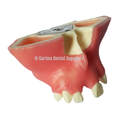 JM Maxillary Sinus
