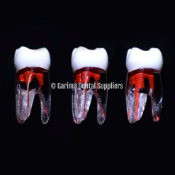 JM Open Pulped Root Canal
